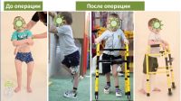 Мальчик снова стал ходить после операции в Центре Илизарова
